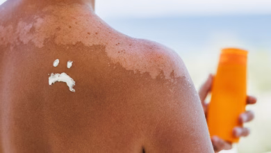 شخص يضع واقي الشمس على شاطئ مشمس صيفي