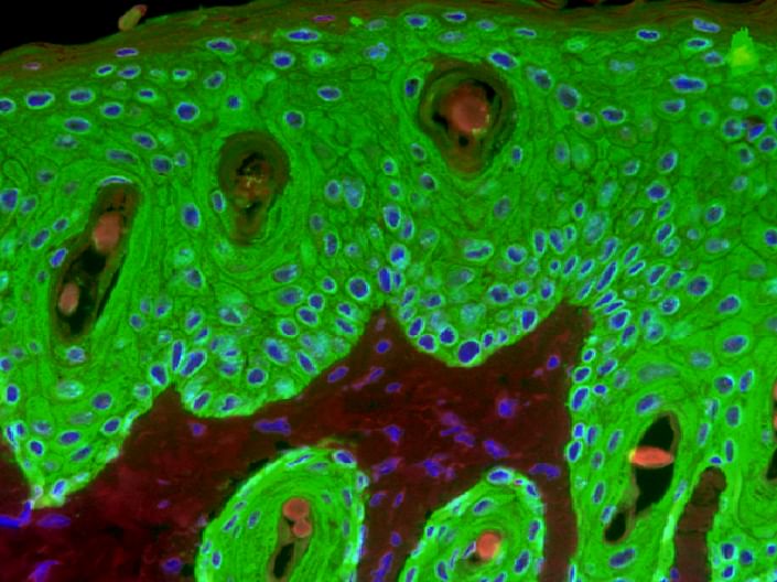 خلايا جذعية كيراتينية مضاءة تفاعلًا مع الالتهاب في تجربة يابانية.